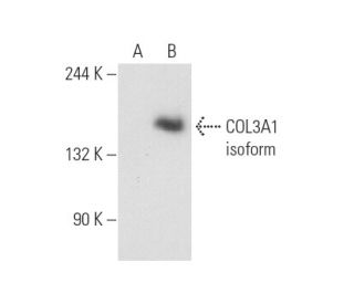 COL3A1 Antibody (B-10) - Western Blotting - Image 131230