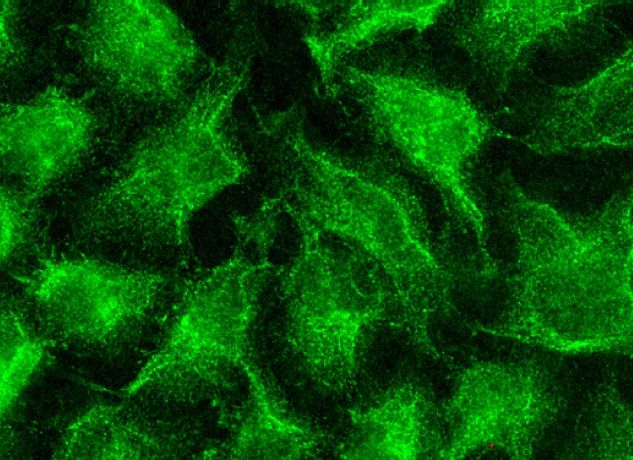 COL4A Antibody (COL-94) | SCBT - Santa Cruz Biotechnology
