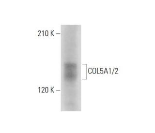 COL5A1/2 Antibody (6F206) - Western Blotting - Image 324617