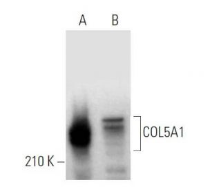 COL5A1 Antibody (B-11) - Western Blotting - Image 373381 
