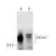 COL5A1 Antibody (B-11) - Western Blotting - Image 373381 