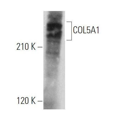 Anti-COL5A1 Antibody (C-5) | SCBT - Santa Cruz Biotechnology