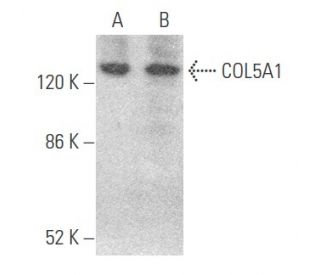 COL5A1 Antibody (E-8) - Western Blotting - Image 355708 