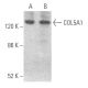 COL5A1 Antibody (E-8) - Western Blotting - Image 355708 