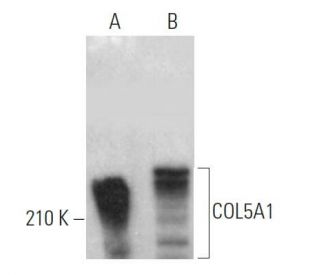 western blotting image from recommended COL5A1 (C-5) monoclonal antibody replacement. Image 373387