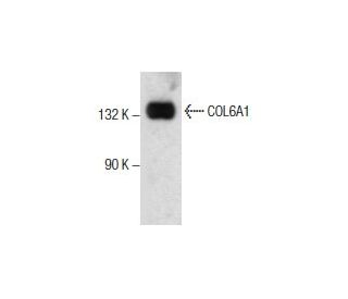 western blotting image from recommended COL6A1 (B-4) monoclonal antibody replacement. Image 285795
