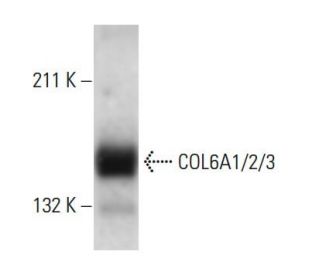 COL6A1/2/3 Antibody (172C2) - Western Blotting - Image 18316 