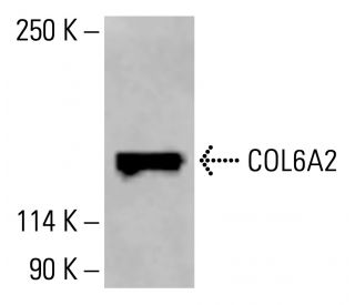 COL6A2 Antibody (B-7) - Western Blotting - Image 414604 