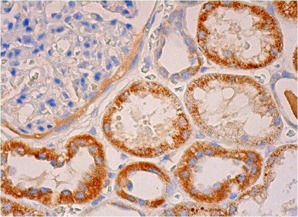 COL7A1 Antibody (LH7.2) | SCBT - Santa Cruz Biotechnology