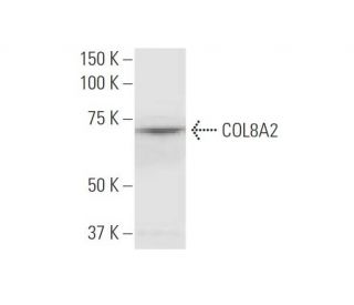 COL8A2 Antibody (1F4) - Western Blotting - Image 347544The Double Nickase Plasmid features a U6 promoter for sgRNA expression, a 20 nt targeting sequence, and a gRNA scaffold to guide Cas9n. It includes a CBh promoter for Cas9n (D10A) and puromycin resistance, GFP for transfection verification, and nuclear localization signals (NLS). The 2A peptide allows co-expression of Cas9n and Puro from a single promoter, enabling precise genome editing with reduced off-target effects. 