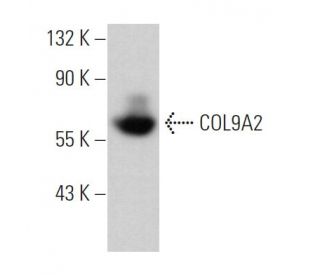 COL9A2 Antibody (H-8) - Western Blotting - Image 366339Each CRISPR/Cas9 Knockout (KO) Plasmid product consists of a pool of 3 plasmids designed to ensure identification and cleavage of a specific gene for maximum knockout efficiency. Each plasmid encodes a unique 20 nt sequence derived from the GeCKO (v2) library. 