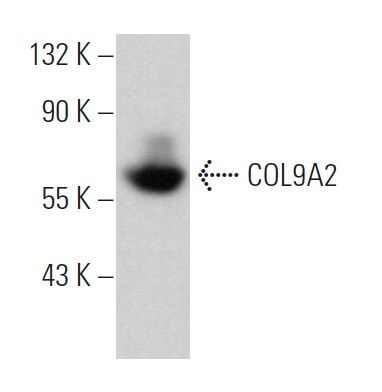 COL9A2 CRISPR/Cas9 KO Plasmid (h) | SCBT - Santa Cruz Biotechnology