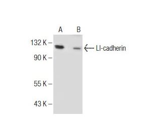 I-cadherin (C-17): sc-6978. Western blot analysis of LI-cadherin expression in Jurkat (A) and COLO 205 (B) whole cell lysa 
