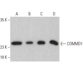COMMD1 Antibody (B-3) - Western Blotting - Image 400012