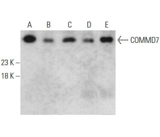 COMMD7 Antibody (AT49B5) - Western Blotting - Image 385120