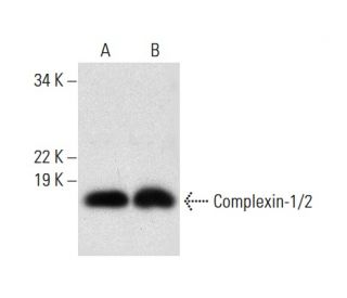 Complexin-1/2 Antibody (D-9) - Western Blotting - Image 301447 