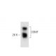 COMT Antibody (4) - Western Blotting - Image 60271 