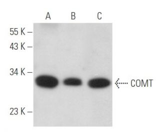 western blotting image from recommended COMT (G-4) monoclonal antibody replacement. Image 356653