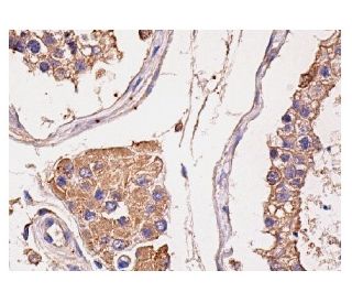 immunohistochemistry image from recommended Conductin (C-6) monoclonal antibody replacement. Image 156798