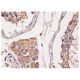 immunohistochemistry image from recommended Conductin (C-6) monoclonal antibody replacement. Image 156798