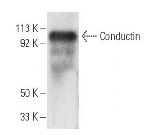 Conductin Antibody (C-6) - Western Blotting - Image 3888SAM Transcription Activation: SAM system utilizing dCas9-VP64, MS2-P65-HSF1, and sgRNA for precise gene transcription activation.