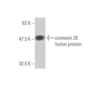 western blotting image from recommended connexin 26 (1C6) monoclonal antibody replacement. Image 348488