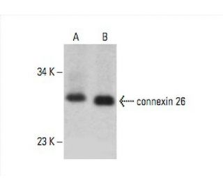 connexin 26 Antibody (P1F5) - Western Blotting - Image 392594Each CRISPR/Cas9 Knockout (KO) Plasmid product consists of a pool of 3 plasmids designed to ensure identification and cleavage of a specific gene for maximum knockout efficiency. Each plasmid encodes a unique 20 nt sequence derived from the GeCKO (v2) library. 