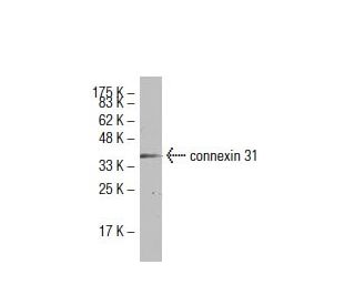connexin 31 Antibody (LL8) - Western Blotting - Image 33455 