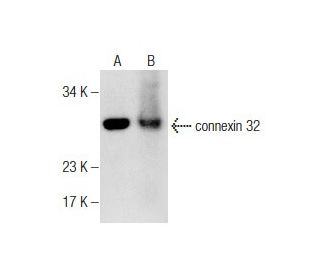 western blotting image from recommended connexin 32 (CXN-32) monoclonal antibody replacement. Image 282489