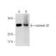 western blotting image from recommended connexin 32 (CXN-32) monoclonal antibody replacement. Image 282489