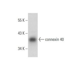 connexin 40 Antibody (B-3) - Western Blotting - Image 298643Each CRISPR/Cas9 Knockout (KO) Plasmid product consists of a pool of 3 plasmids designed to ensure identification and cleavage of a specific gene for maximum knockout efficiency. Each plasmid encodes a unique 20 nt sequence derived from the GeCKO (v2) library. 