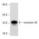 western blotting image from recommended connexin 45 (G-7) monoclonal antibody replacement. Image 356836
