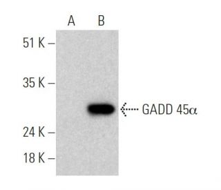 GADD 45&alpha; (A-3): sc-515568. Western blot analysis of GADD 45&alpha; expression in non-transfected: sc-110760 (A) and 