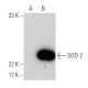 SOD-2 (E-10): sc-137254 hrp. Direct western blot analysis of SOD-2 expression in non-transfected: sc-110760 (A) and human 