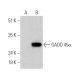 GADD 45α (A-3): sc-515568. Western blot analysis of GADD 45α expression in non-transfected: sc-110760 (A) and 