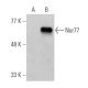 Nur77 (C-5) HRP: sc-365113 HRP. Direct western blot analysis of Nur77 expression in non-transfected: sc-110760 (A) and hum