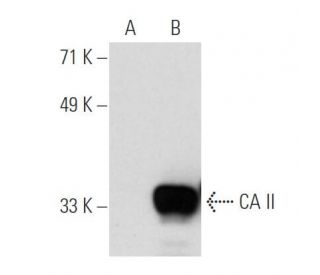 Control 293T Lysate | SCBT - Santa Cruz Biotechnology