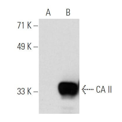 スターダスト　確認用 Control 293T Lysate | SCBT - Santa Cruz Biotechnology