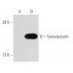 Somatostatin (G-10): sc-55565. Western blot analysis of human Somatostatin expression in non-transfected: sc-117750 (A) an 