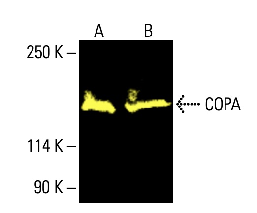 チャコ　COVOバージョン3 catalase-antibody-h-9-western-