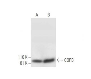 COPB Antibody (D-10) - Western Blotting - Image 296987 