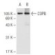 COPB Antibody (D-9) - Western Blotting - Image 62482