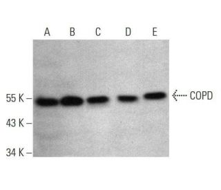 COPD Antibody (E-12) - Western Blotting - Image 351691 