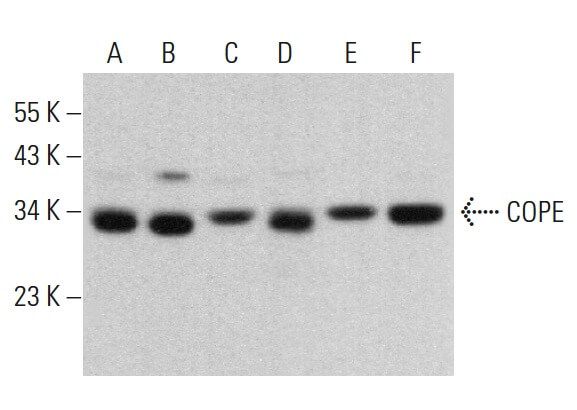 COPE Antibody (C-4) | SCBT - Santa Cruz Biotechnology