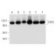 western blotting image from recommended COPG (A-10) monoclonal antibody replacement. Image 299449