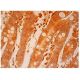 copine 1/3 Antibody (A-7) - Immunohistochemistry - Image 304838 