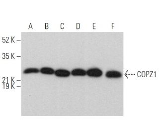 COPZ1 Antibody (F-11) - Western Blotting - Image 375884 