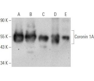 Coronin 1A Antibody (14.1) - Western Blotting - Image 368206 