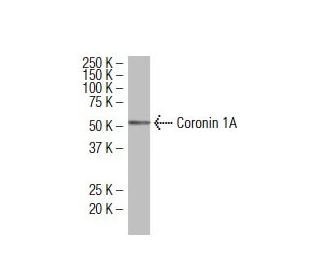 Coronin 1A Antibody (14.1) - Western Blotting - Image 34295 