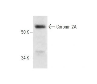 Coronin 2A Antibody (C-7) - Western Blotting - Image 295846 
